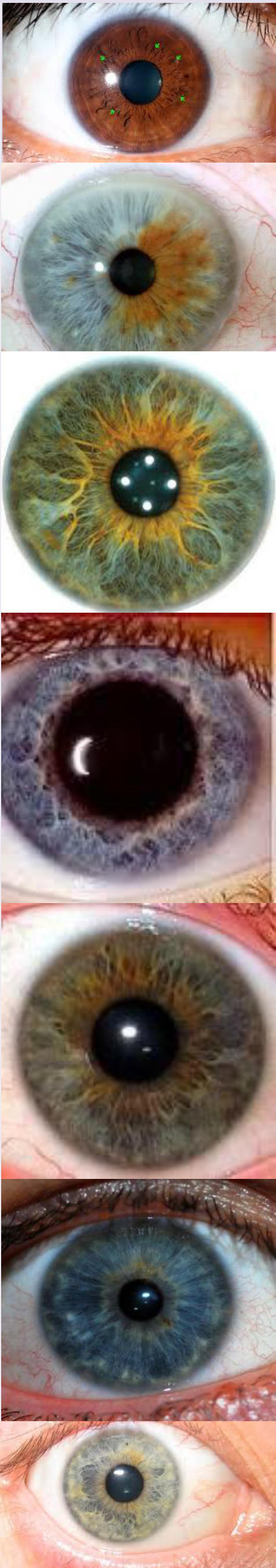eyes